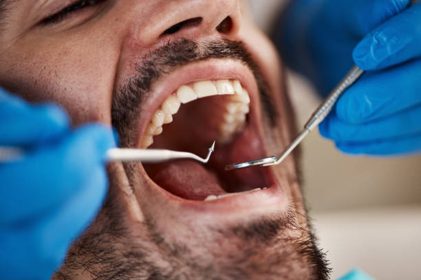 Best Emergency Treatment for Jaw Pain or Injury in Clancy, MT